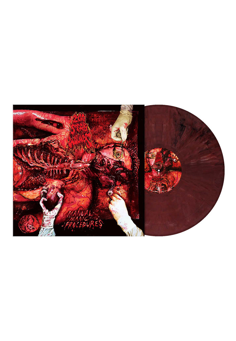 200 Stab Wounds - Manual Manic Procedures Ltd. Dark Liver - Marbled Vinyl | Neutral-Image